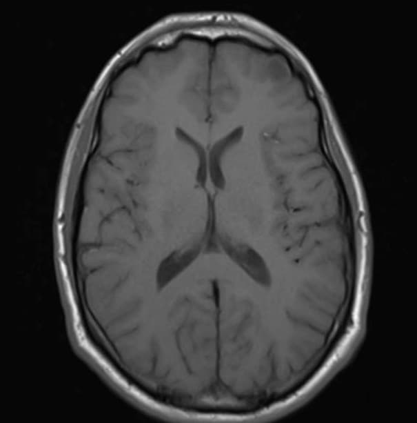 MRI Sample 3